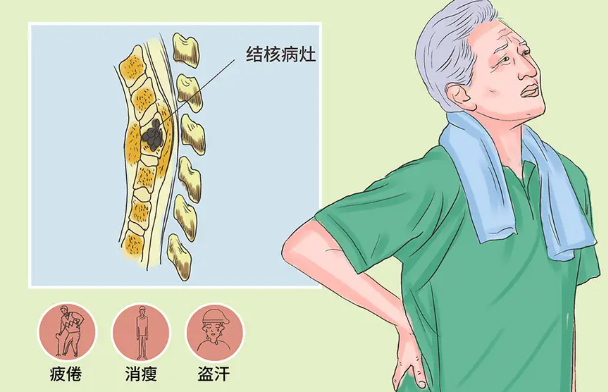 邵陽創(chuàng)傷骨科,邵陽風濕病區(qū),邵陽骨質(zhì)增生,邵陽關節(jié)病區(qū),邵陽頸椎病區(qū)